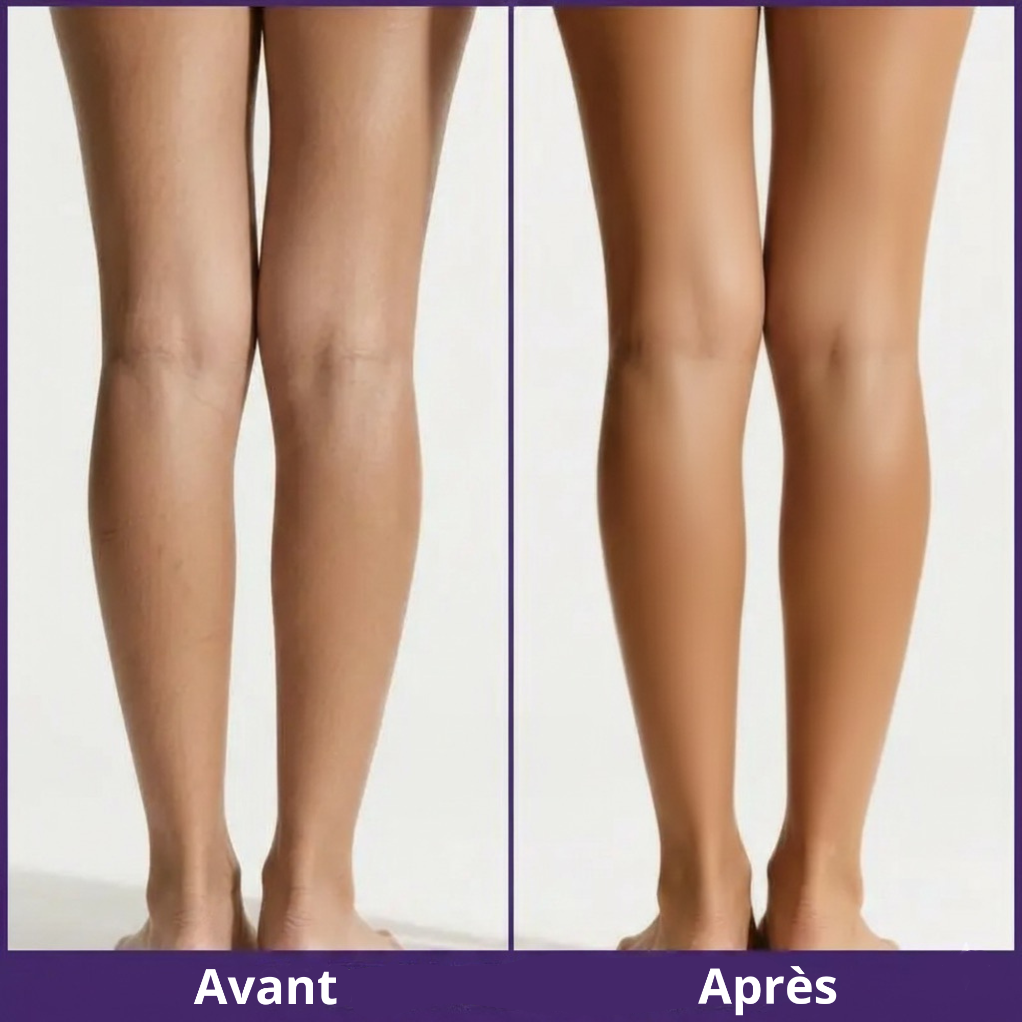 Althea - Dermalysse®